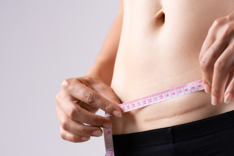 Chirurgie de l'obésité