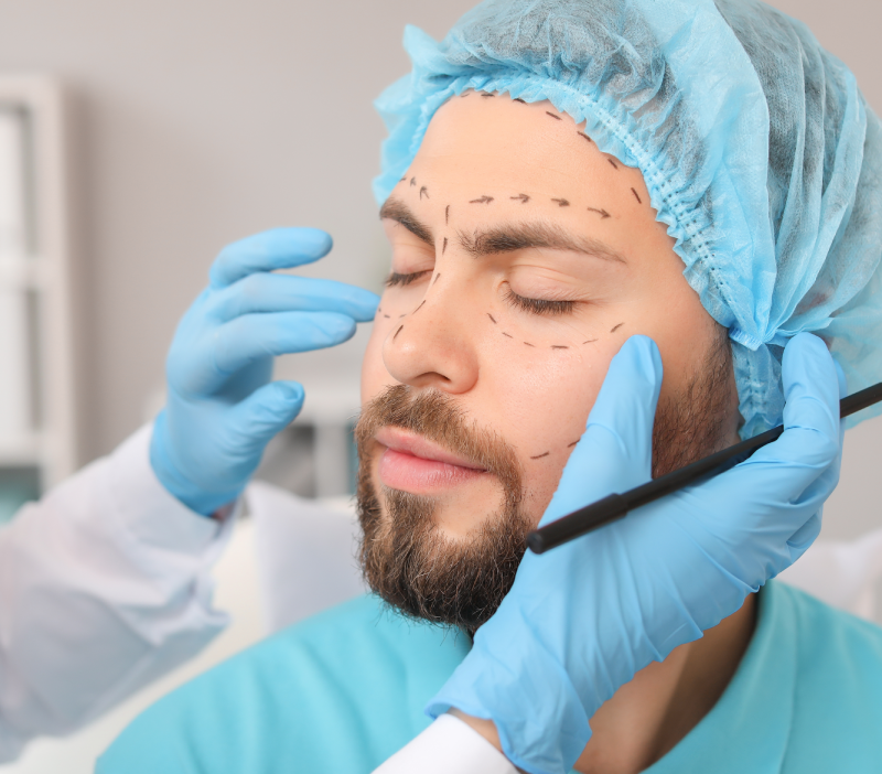 Blépharoplastie deux paupières sup ou inf